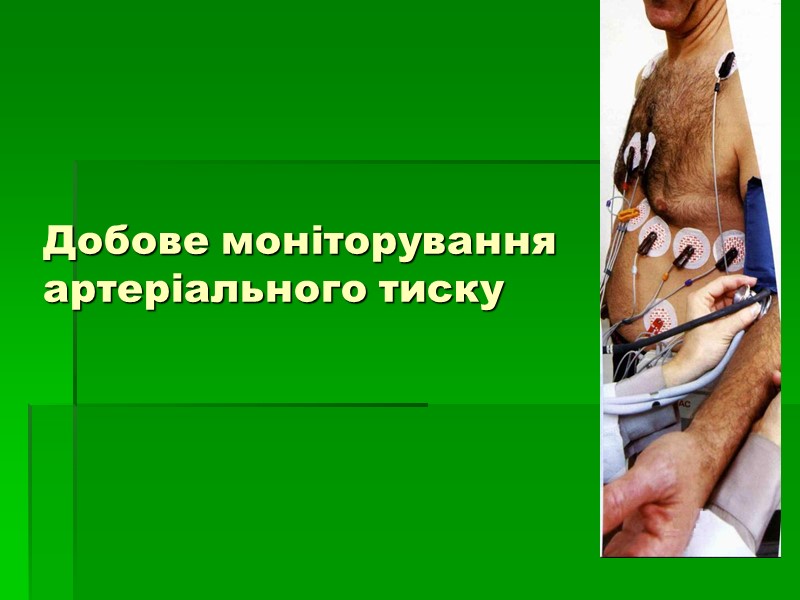 Добове моніторування артеріального тиску